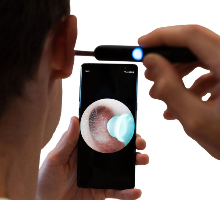 Smart Bud - Ear Cleaner with Camera